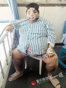 新“重庆第一胖”体重360斤 坐公交只能走后门 新“重庆第一胖”体重360斤 坐公交只能走后门